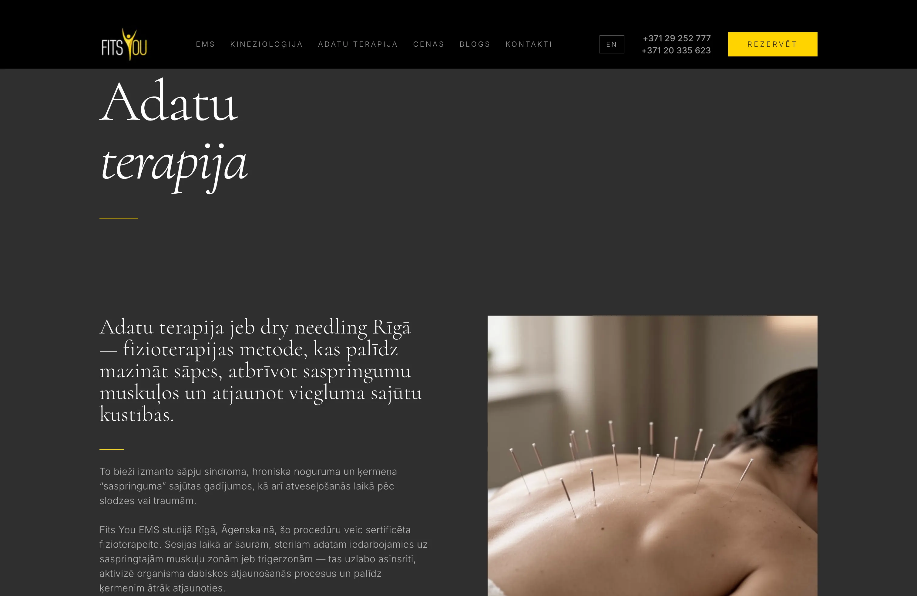 FITS EMS studijas adatu terapijas pakalpojuma lapa